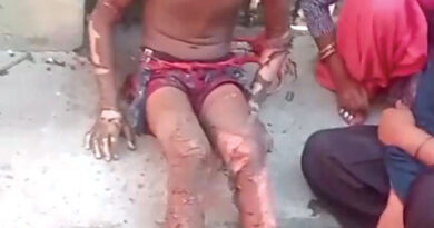 रुद्रपुर में गैस सिलेंडर फटने से बड़ा हादसा, पिता-पुत्र समेत चार लोग झुलसे